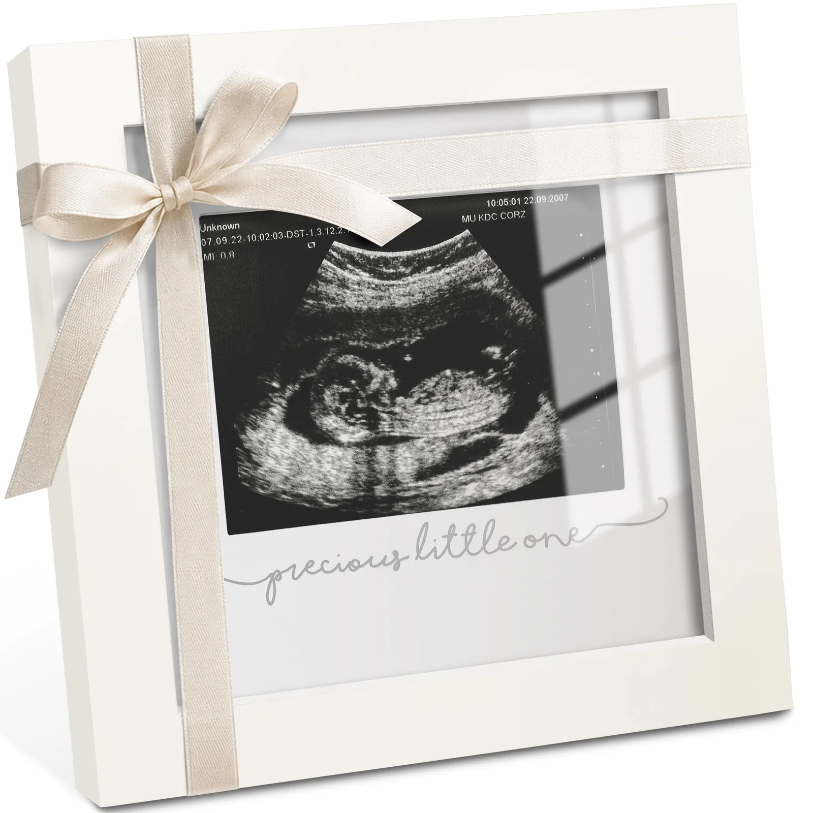 Cadre sonogramme de bébé